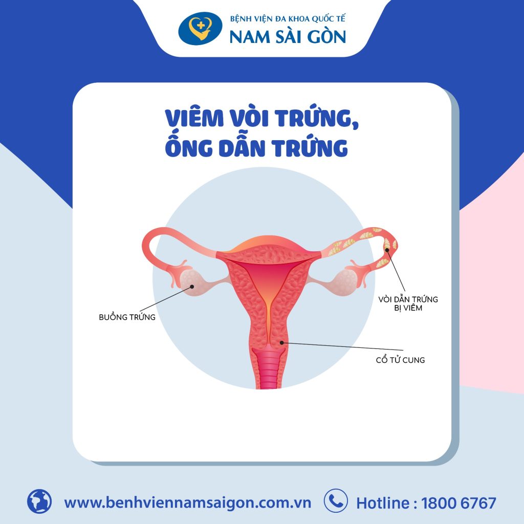 Viêm Vòi Trứng, Ống Dẫn Trứng