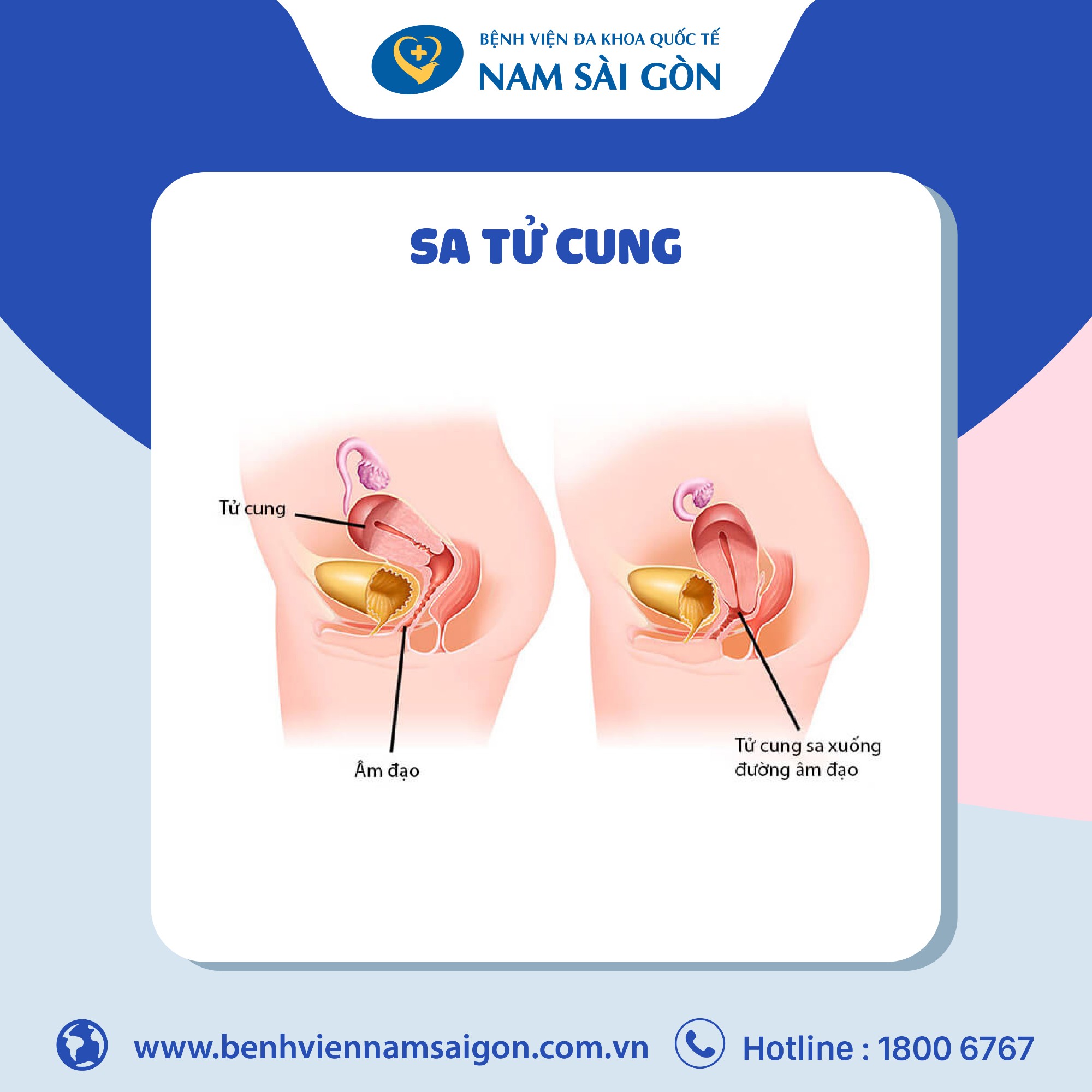 Sa Tử Cung