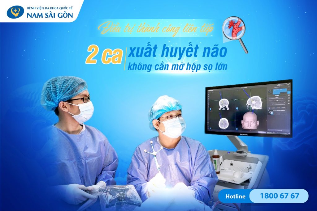 2 TRƯỜNG HỢP XUẤT HUYẾT NÃO ĐƯỢC ĐIỀU TRỊ MÀ KHÔNG CẦN MỞ HỘP SỌ LỚN 2 Điều Trị Thành Công Liên Tiếp Hai Trường Hợp Xuất Huyết Não Không Cần Mở Hộp Sọ Lớn