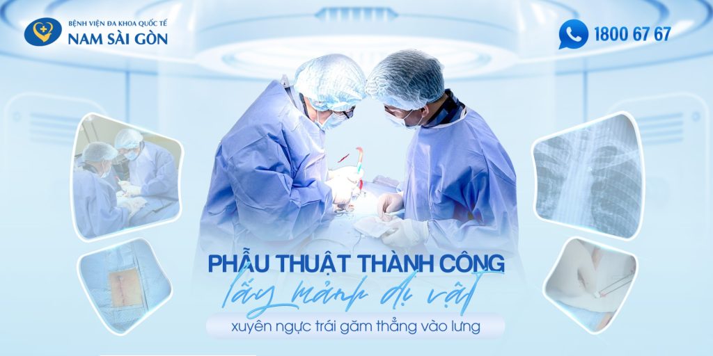 SUCCESSFUL SURGERY TO REMOVE A BULLET FRAGMENT PIERCING THROUGH THE CHEST AND LODGED IN THE BACK 2 14 01