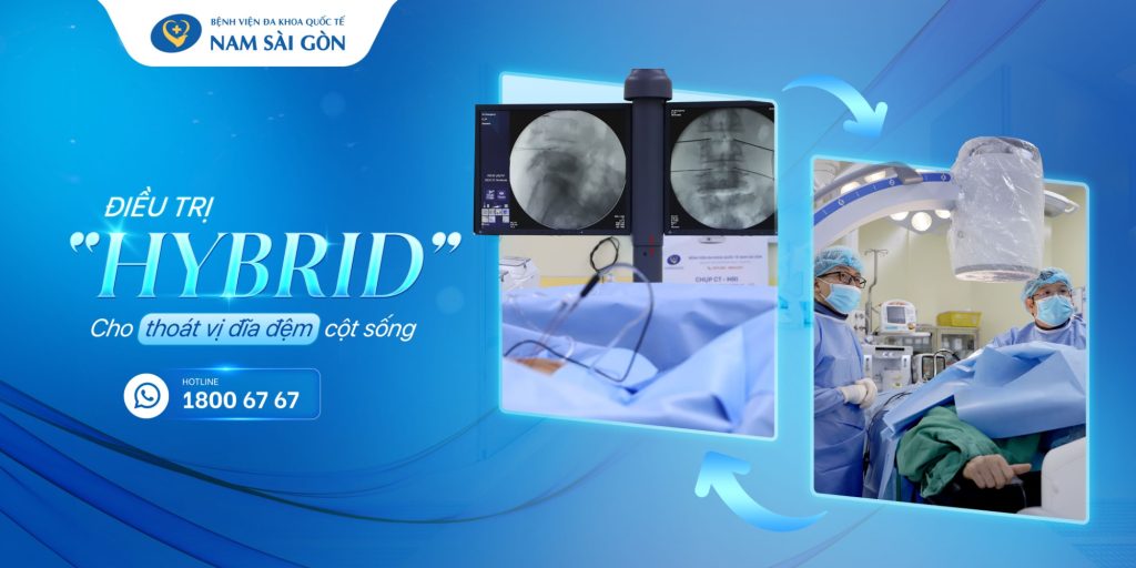 ĐIỀU TRỊ "HYBRID" CHO THOÁT VỊ ĐĨA ĐỆM CỘT SỐNG 2 1670 01 9