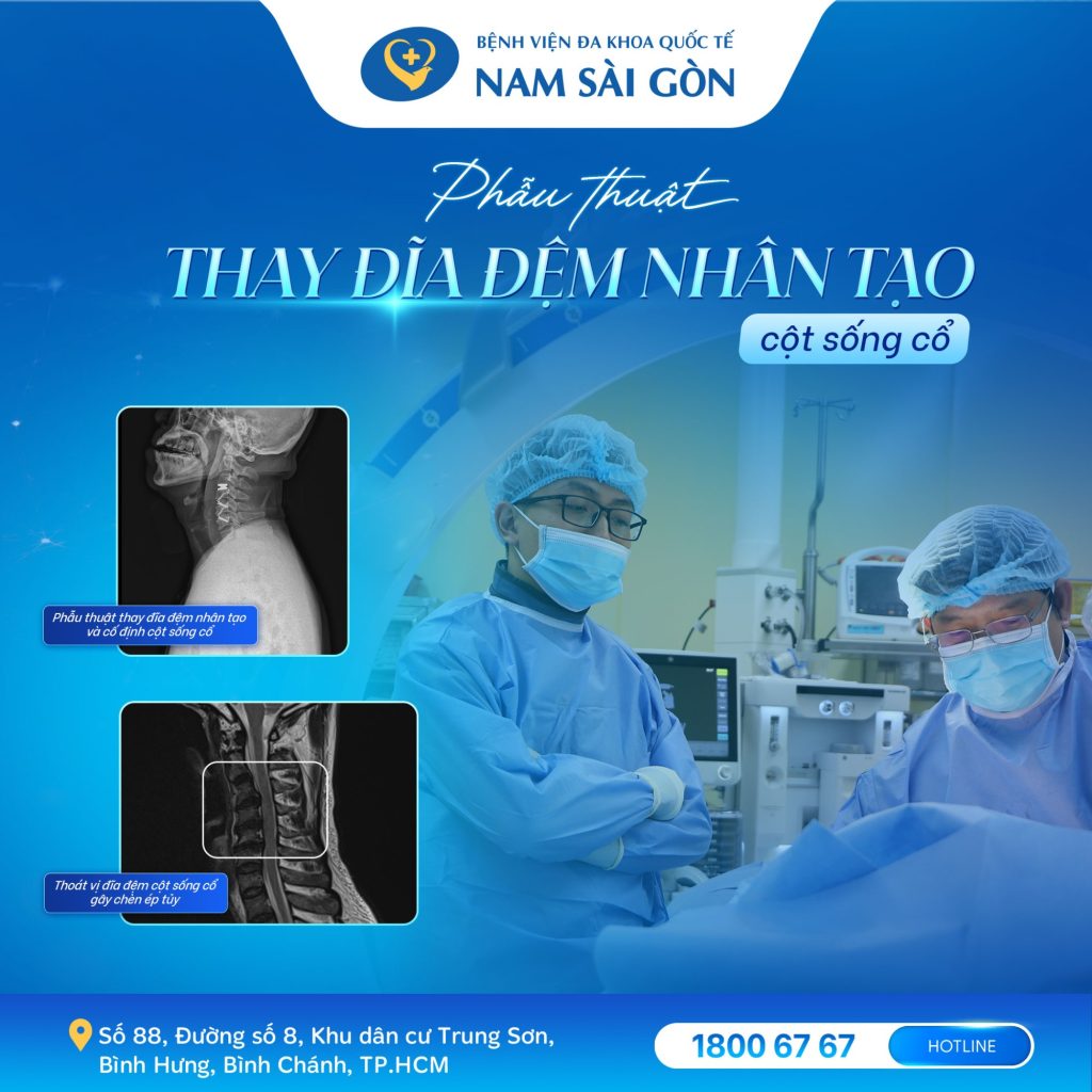 ĐIỀU TRỊ "HYBRID" CHO THOÁT VỊ ĐĨA ĐỆM CỘT SỐNG 4 1670 03 4