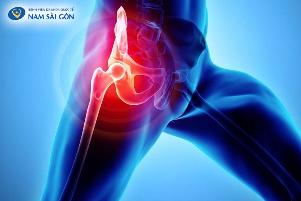 PHẪU THUẬT THAY KHỚP HÁNG VÀ NHỮNG ĐIỀU CẦN BIẾT 2 1718 2