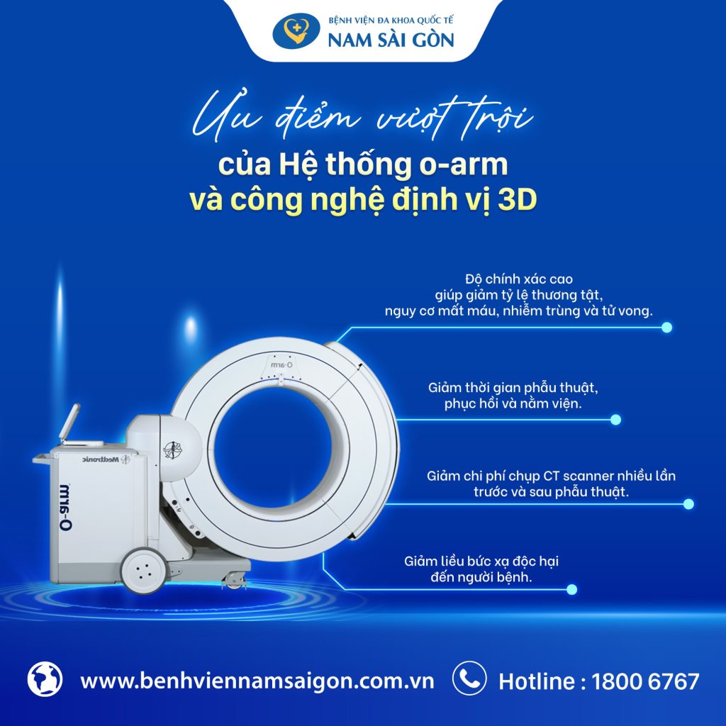 ĐIỀU TRỊ THOÁT VỊ ĐĨA ĐỆM NHIỀU TẦNG CỘT SỐNG THẮT LƯNG VỚI HỆ THỐNG O-ARM VÀ CÔNG NGHỆ ĐỊNH VỊ 3D 3 3 3