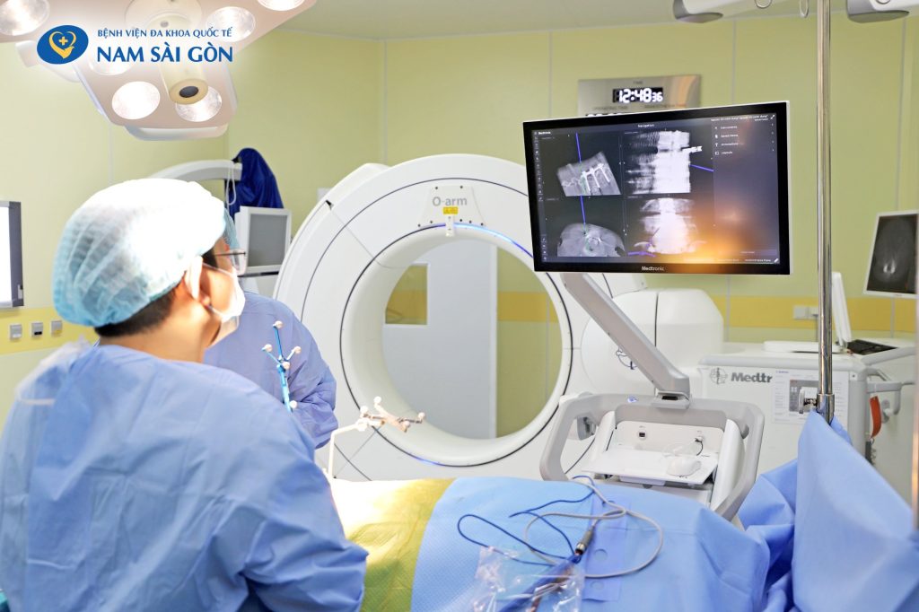 PHẪU THUẬT CỘT SỐNG XÂM LẤN TỐI THIỂU ỨNG DỤNG CÔNG NGHỆ O-ARM VÀ ĐỊNH VỊ HÌNH ẢNH 3 CHIỀU NAVIGATION 2 482495678f9444ca1d85