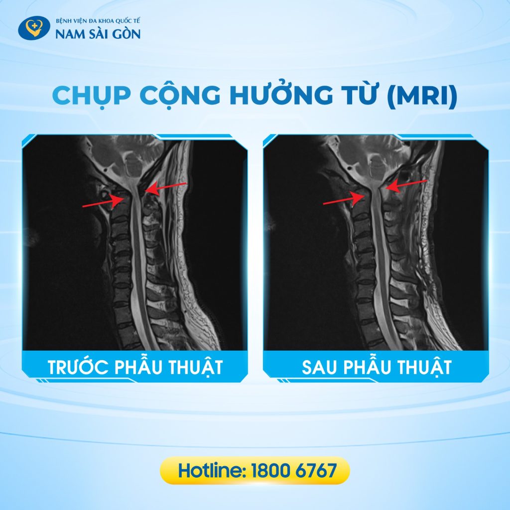 535 post chan thuong cot song co bac tuan 07 2 10