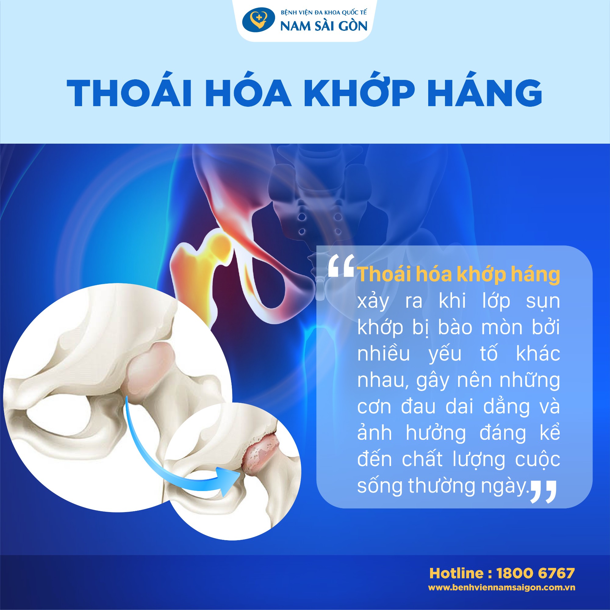 794 thoai hoa khop hang 02 1 1