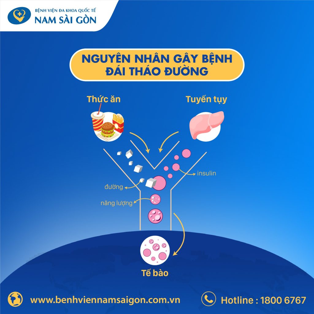 ĐÁI THÁO ĐƯỜNG: NGUYÊN NHÂN, DẤU HIỆU, CHUẨN ĐOÁN VÀ CÁCH ĐIỀU TRỊ 3 873 huong ung ngay dai thao duong1 08 1