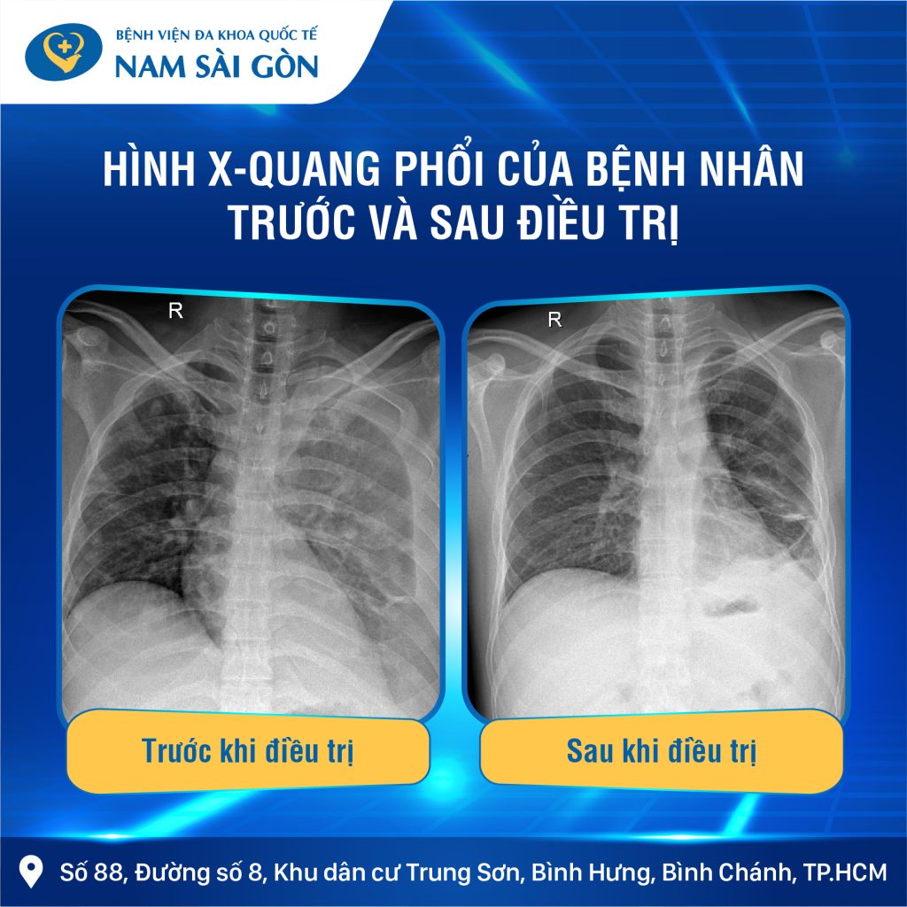 887 post virus an thit nguoi op2 02 1