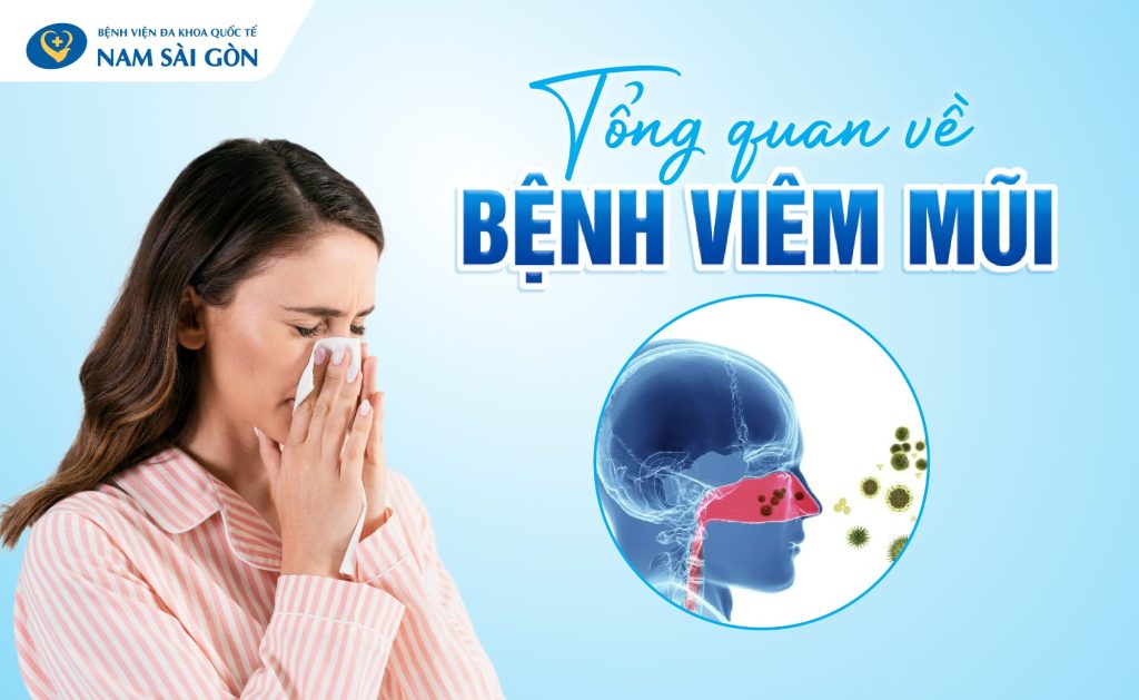 VIÊM MŨI - TRIỆU CHỨNG, PHÂN LOẠI, ĐIỀU TRỊ VÀ CÁCH PHÒNG NGỪA 2 benh viem mui 03 bv web 1