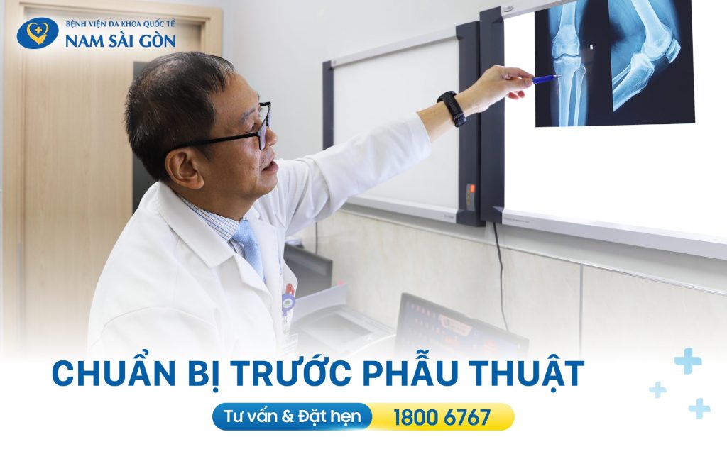 chuan bi truoc phau thuat dut day chang