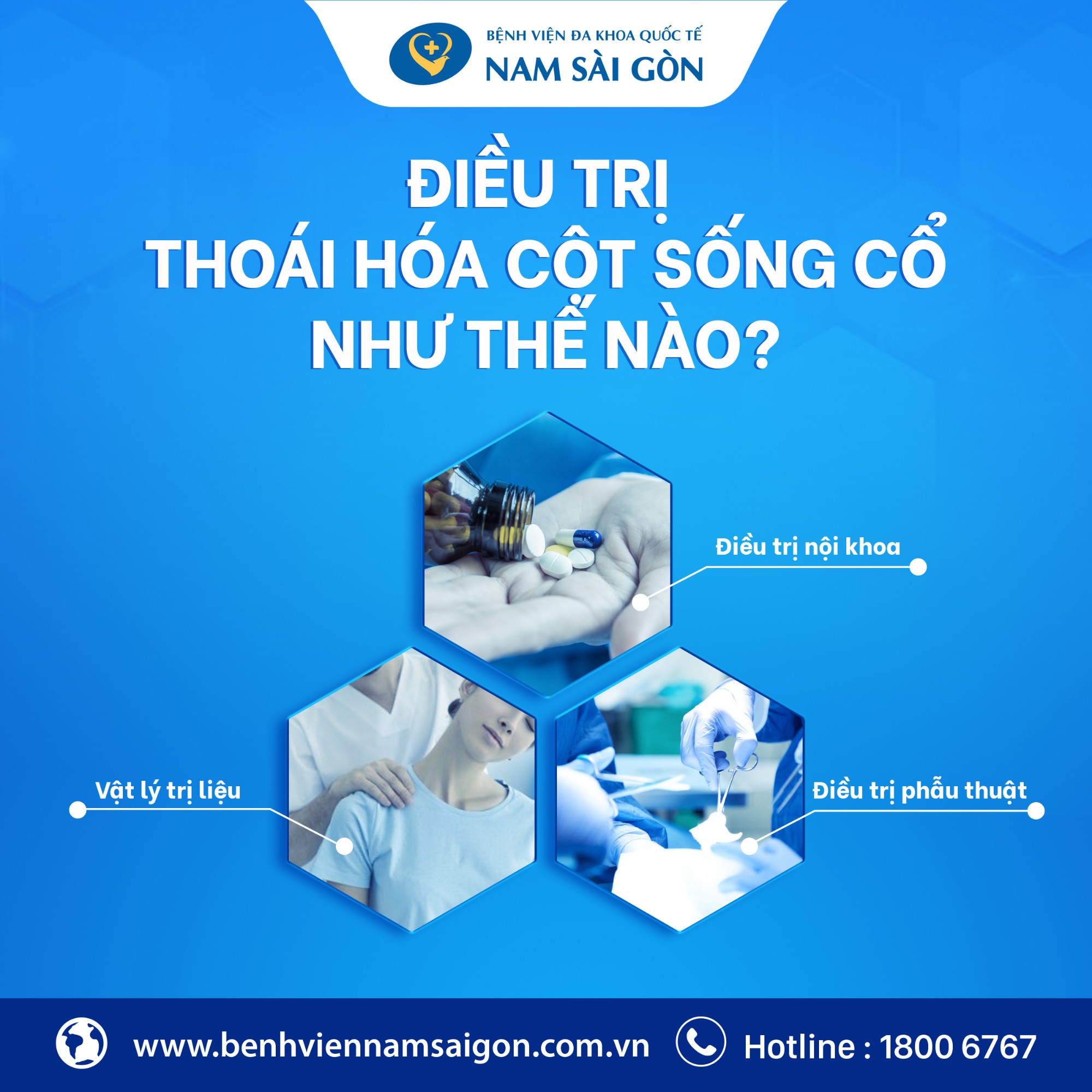 dieu tri thoai hoa cot song co 4