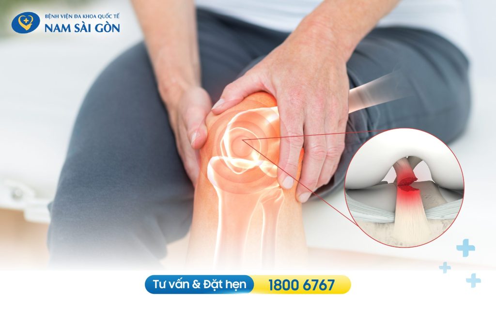 dut day chang cheo truoc