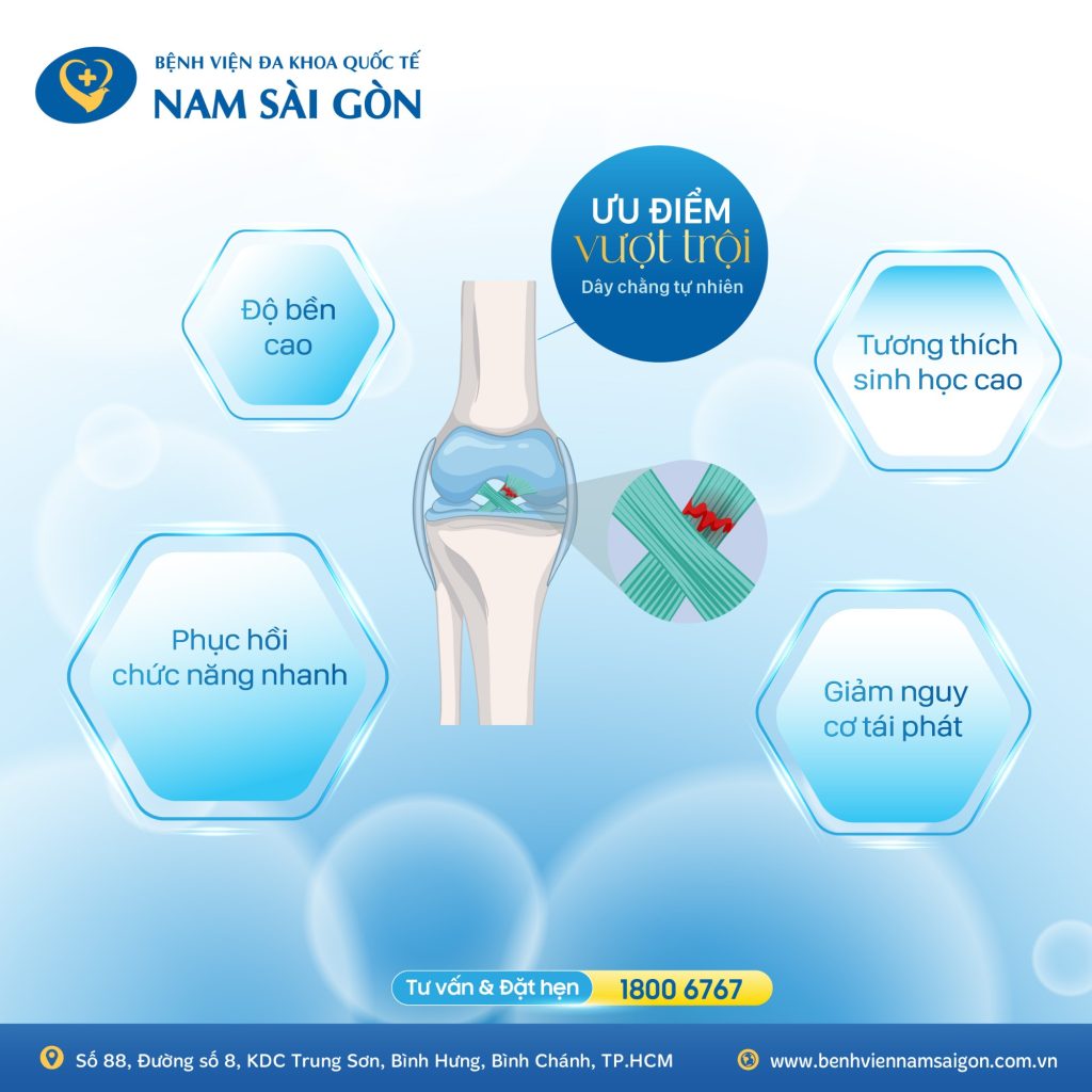 hinh 1 web uu diem cua day chang nhan tao 01 1