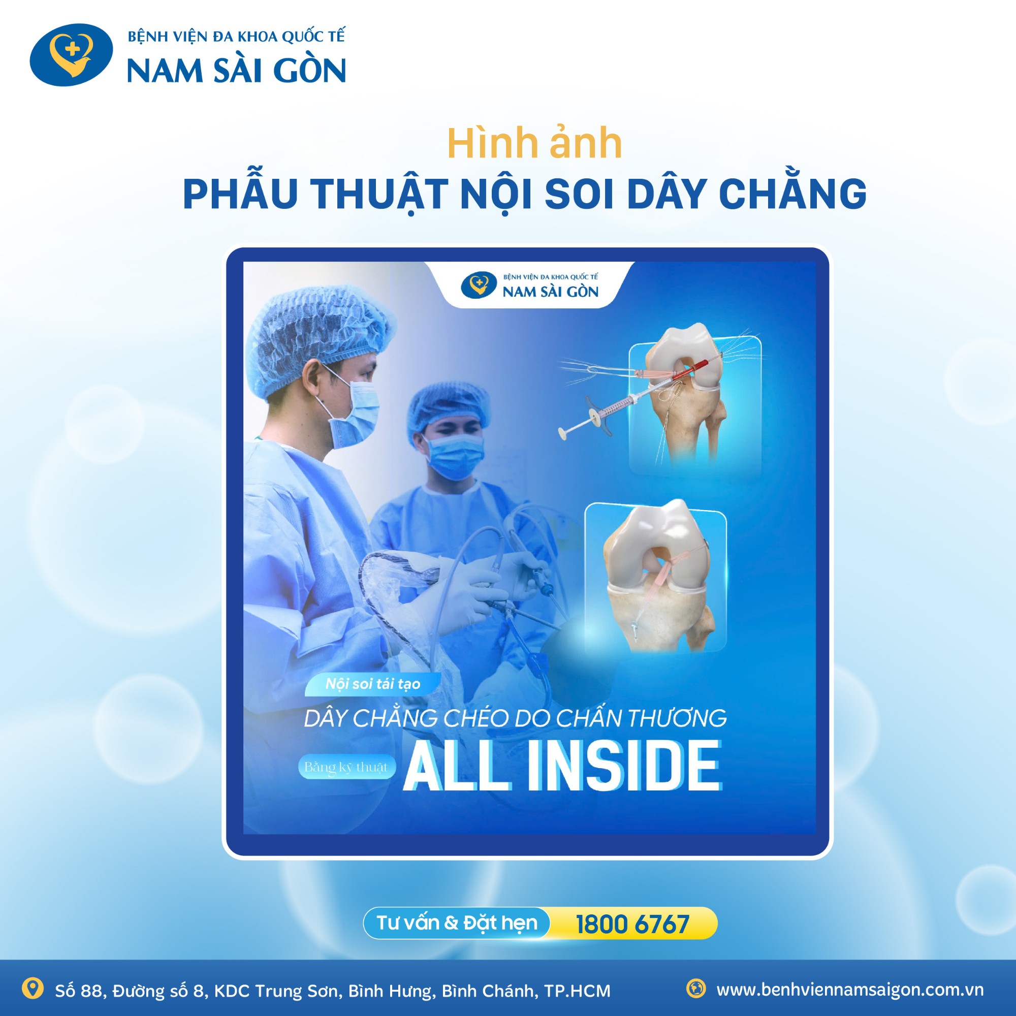 hinh 2 noi soi day chang 01 1