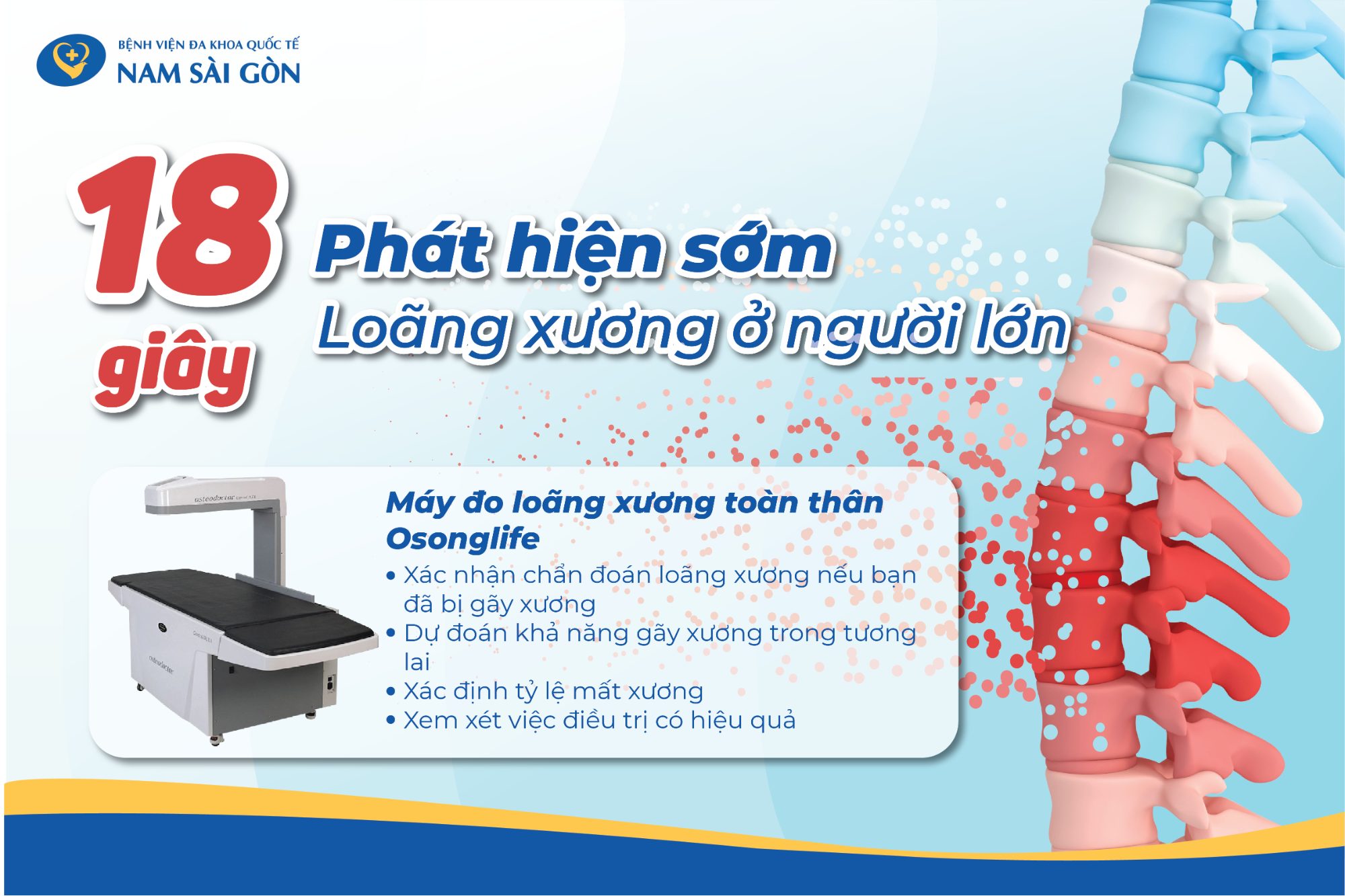 BỆNH LOÃNG XƯƠNG – NGUYÊN NHÂN, DẤU HIỆU, CHẨN ĐOÁN VÀ ĐIỀU TRỊ