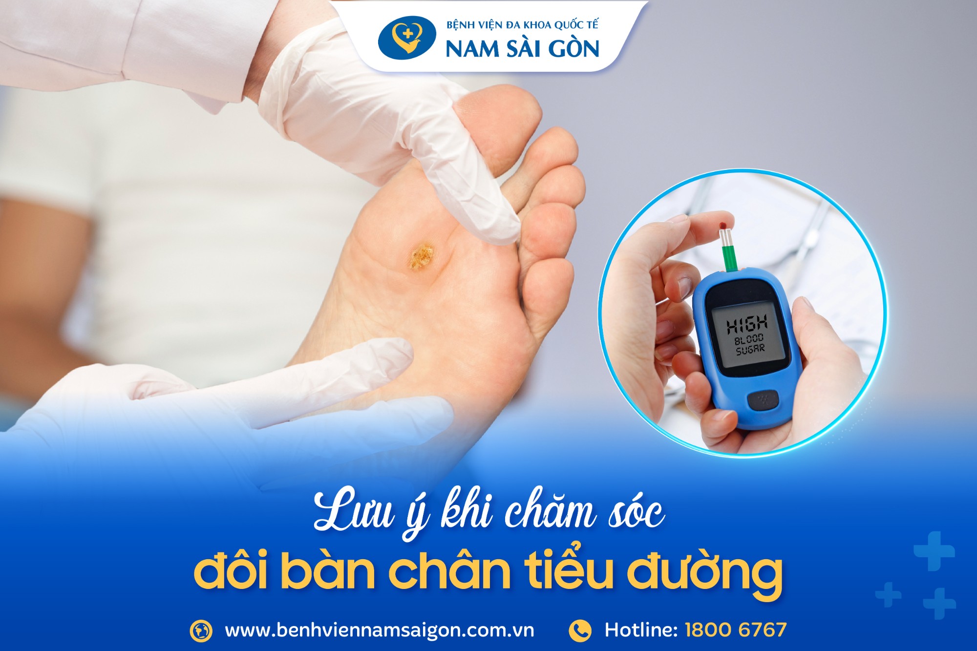 CÁCH CHĂM SÓC BÀN CHÂN TIỂU ĐƯỜNG