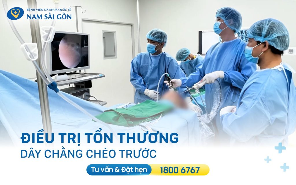 phau thuat dieu tri dut day chang cheo