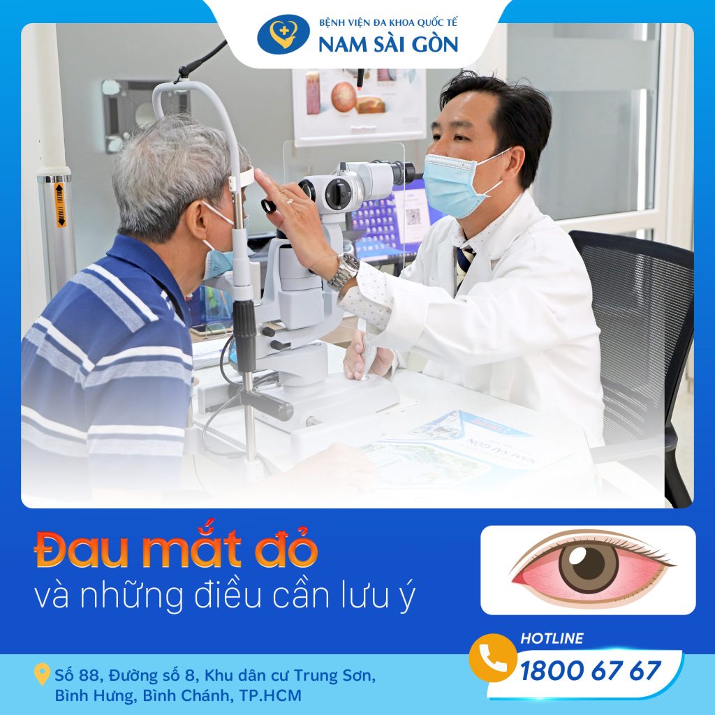 BỆNH ĐAU MẮT ĐỎ: DẤU HIỆU, NGUYÊN NHÂN, BIẾN CHỨNG VÀ CÁCH ĐIỀU TRỊ 2 post1 9