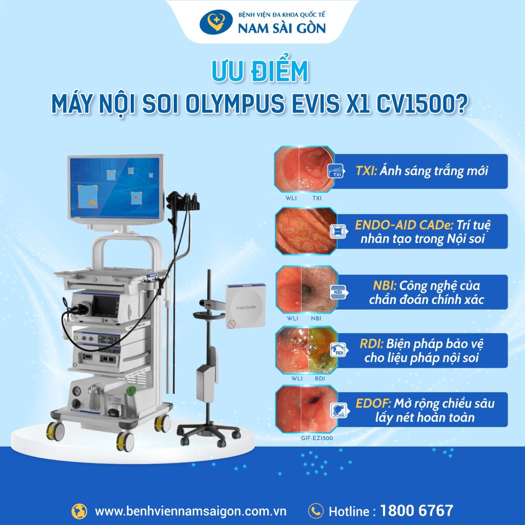 post may noi soi cv1500 03 1