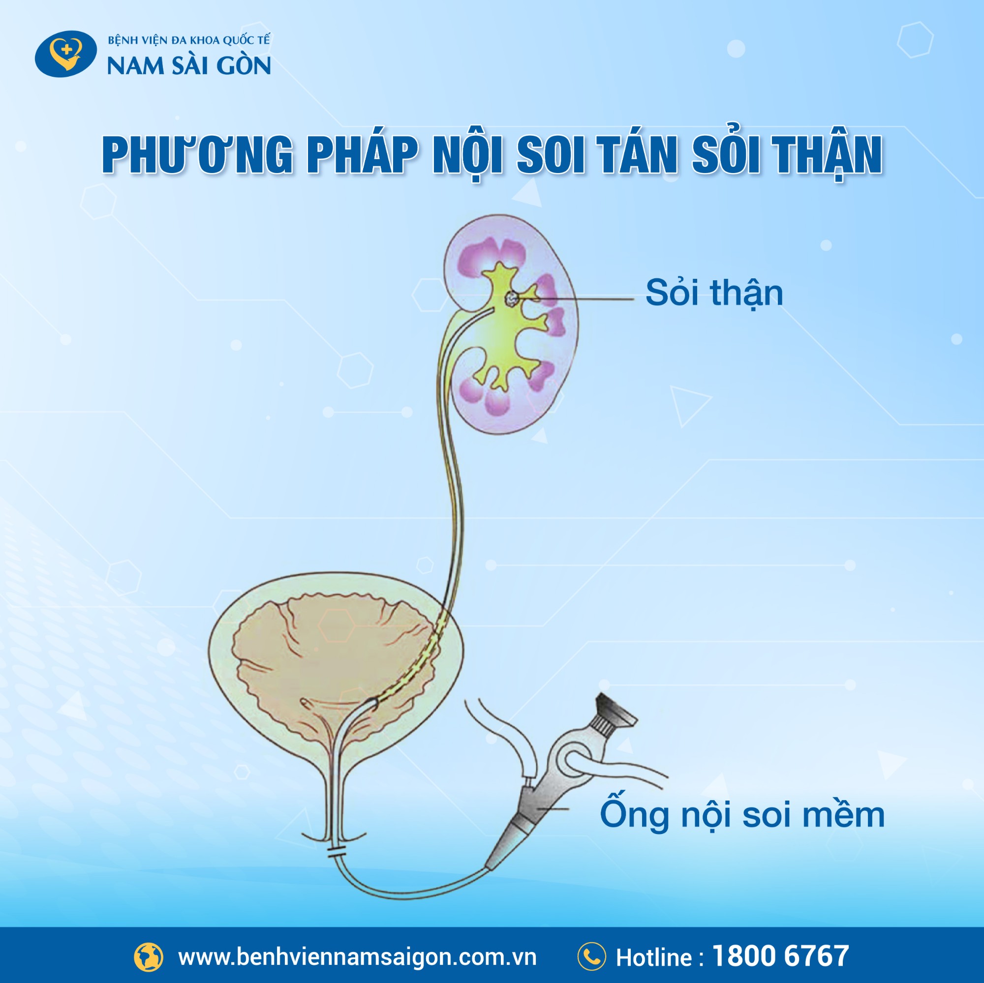 post thay khop goi va noi soi tan soi than 03 1