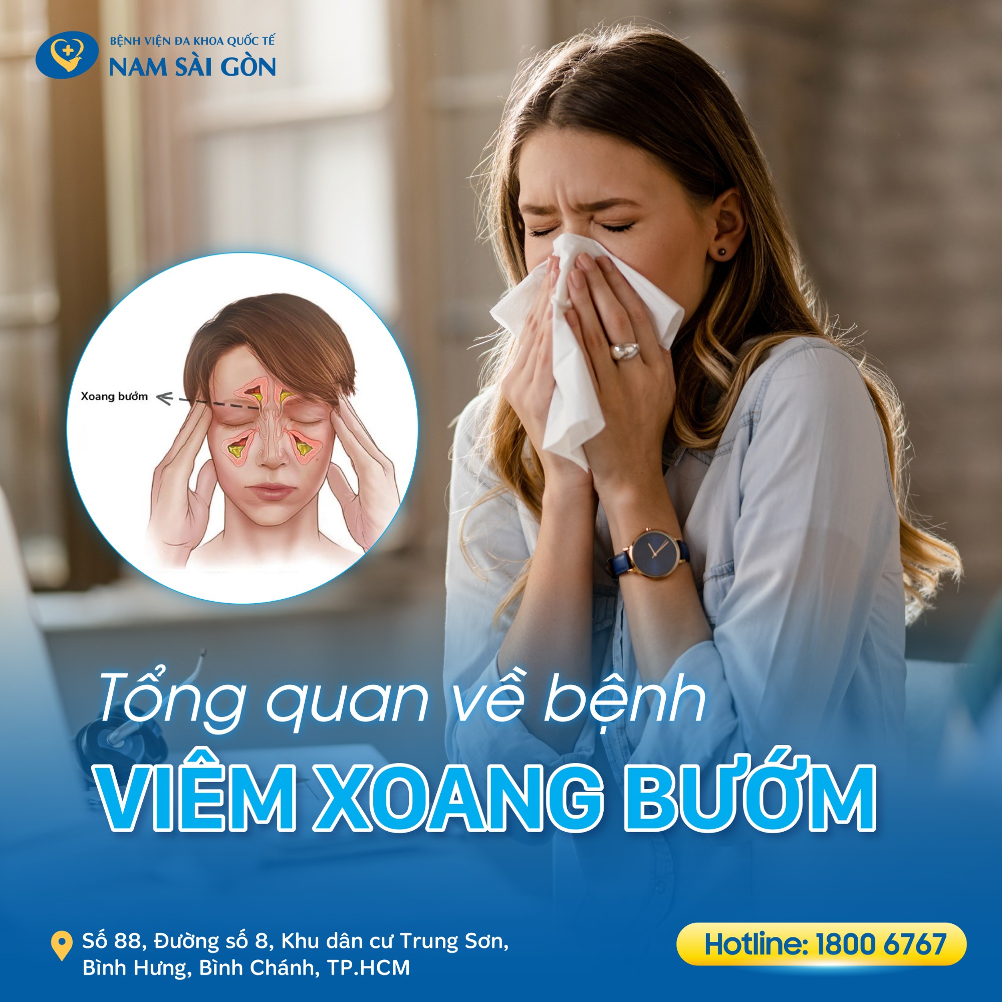 post viem xoang buom 01 1