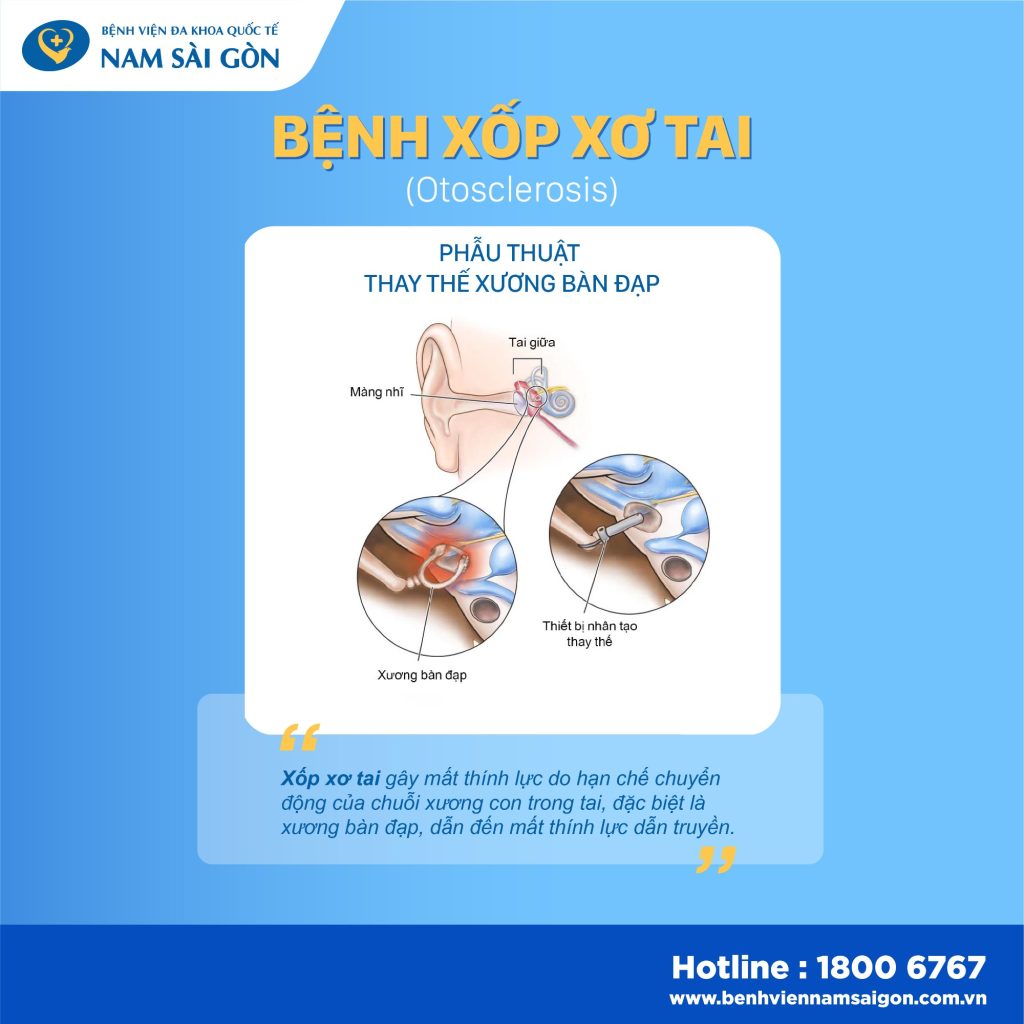 post xop xo tai 03 1