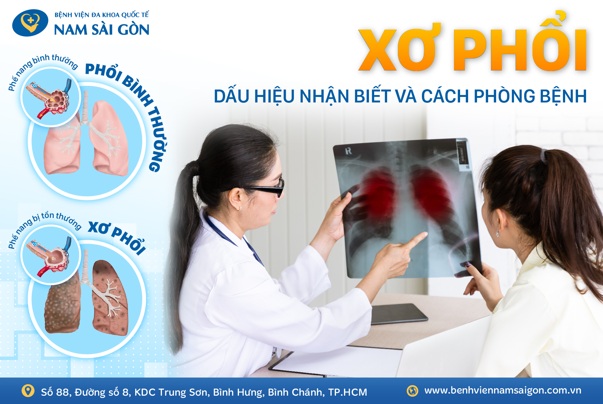 seo thiet ke bai dang seo ve xo phoi 01 3