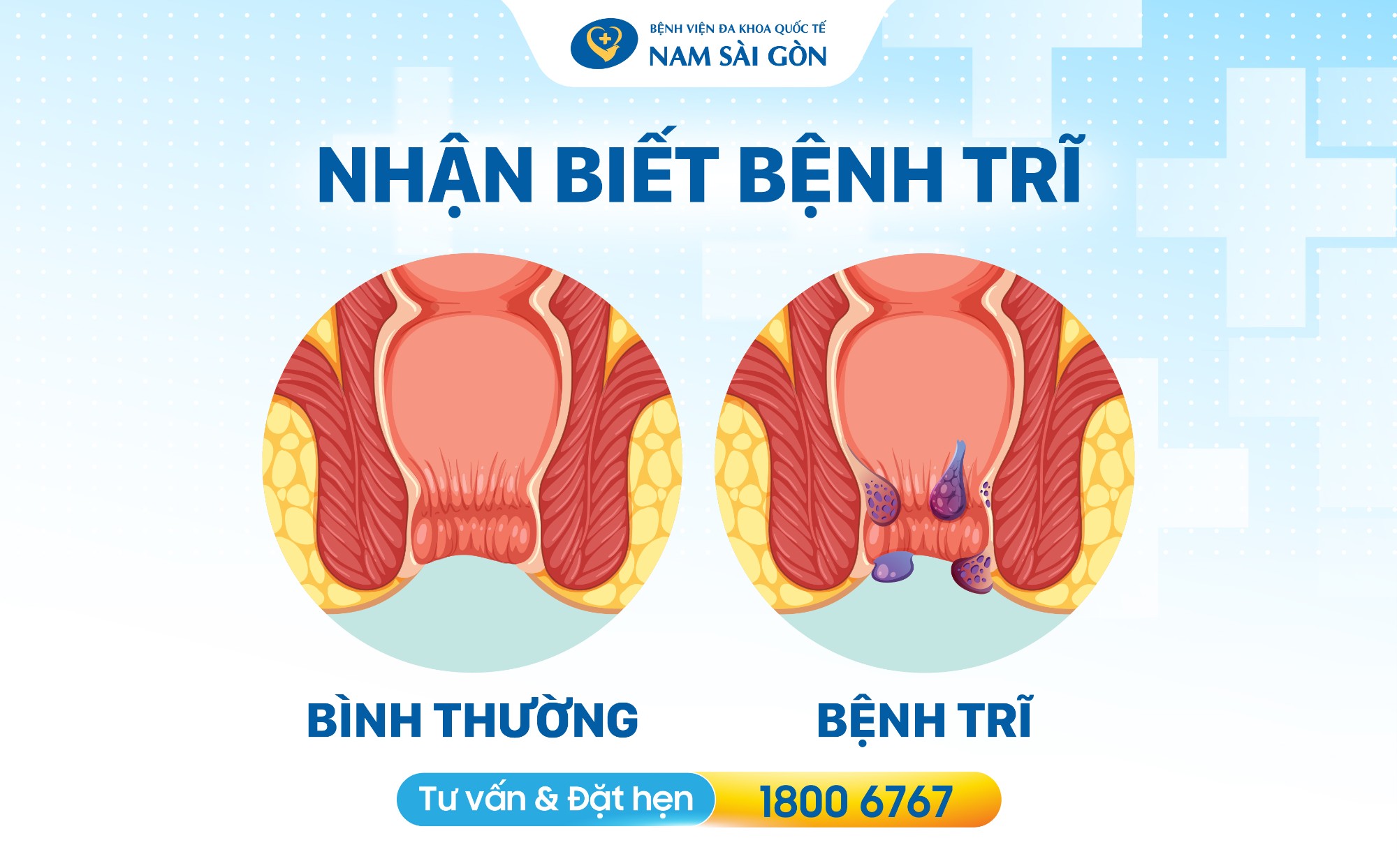 seo thiet ke hinh anh bai dang benh tri 04 1
