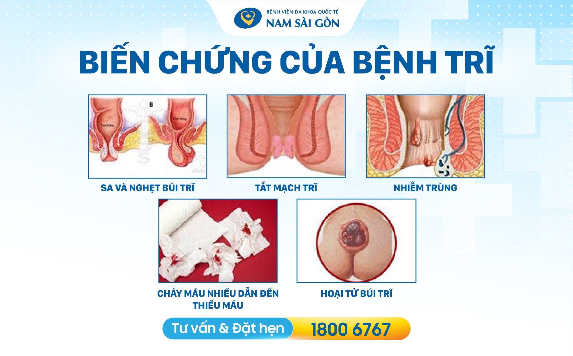 seo thiet ke hinh anh bai dang benh tri 07 1