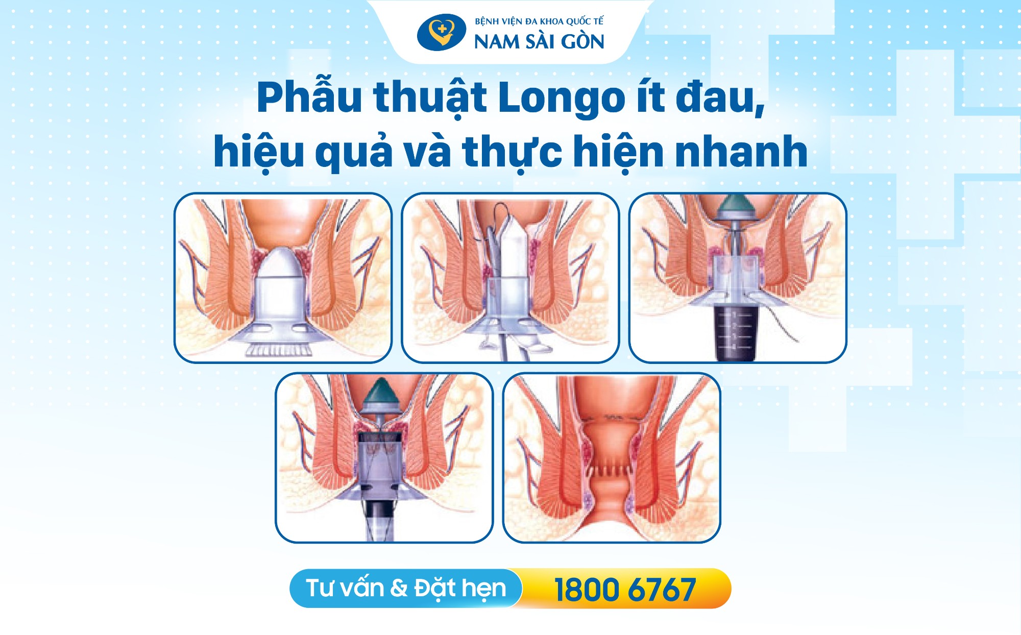 seo thiet ke hinh anh bai dang benh tri 09 1