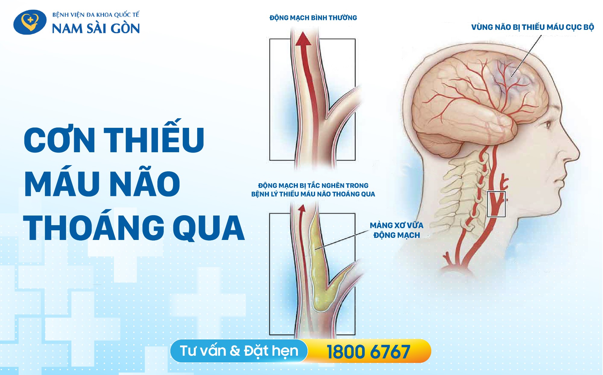 seo thiet ke hinh anh bai dang con thieu mau nao thoang qua 02 1