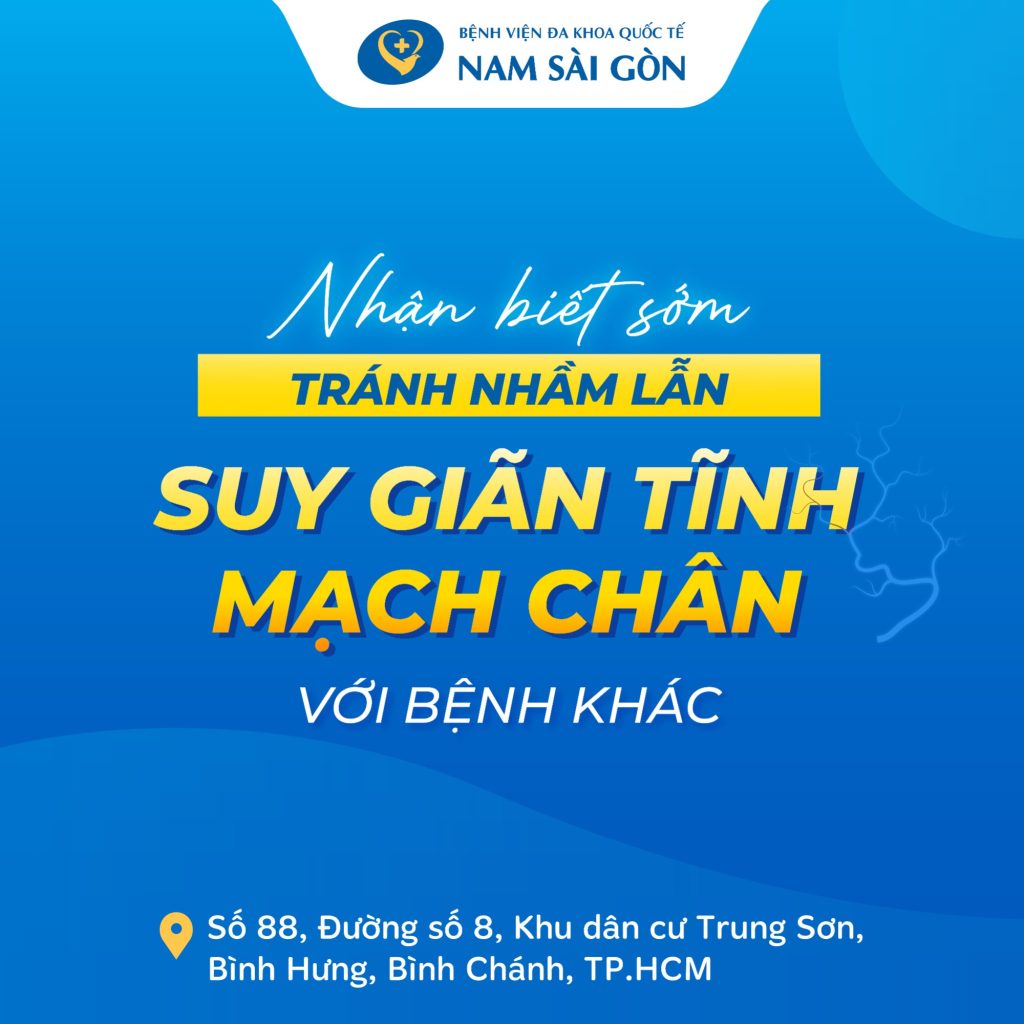 suy gian tinh mach chan 01 1