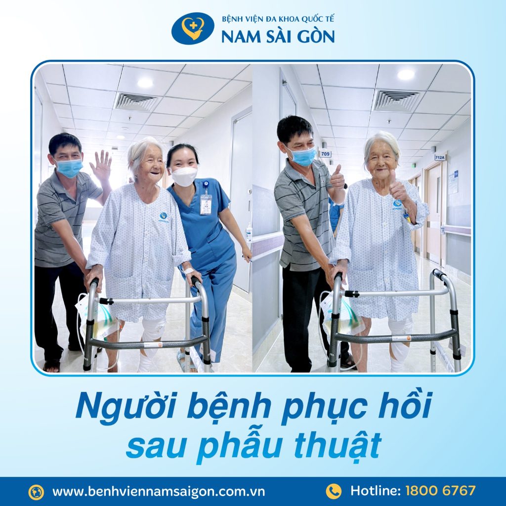 thay khop hang ban phan 04 1