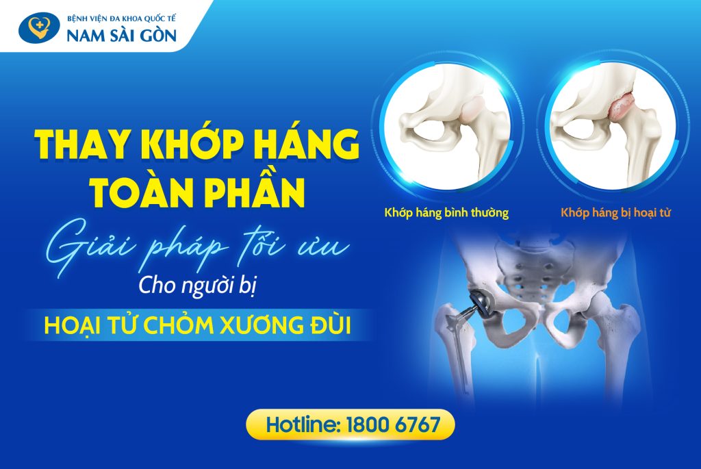 thay khop hang toan phan 04 1