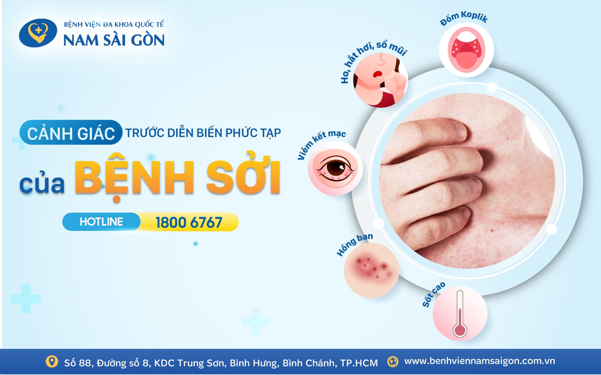thiet ke hinh bai dang canh giac truoc dien bien phuc tap cua benh soi website 1 2