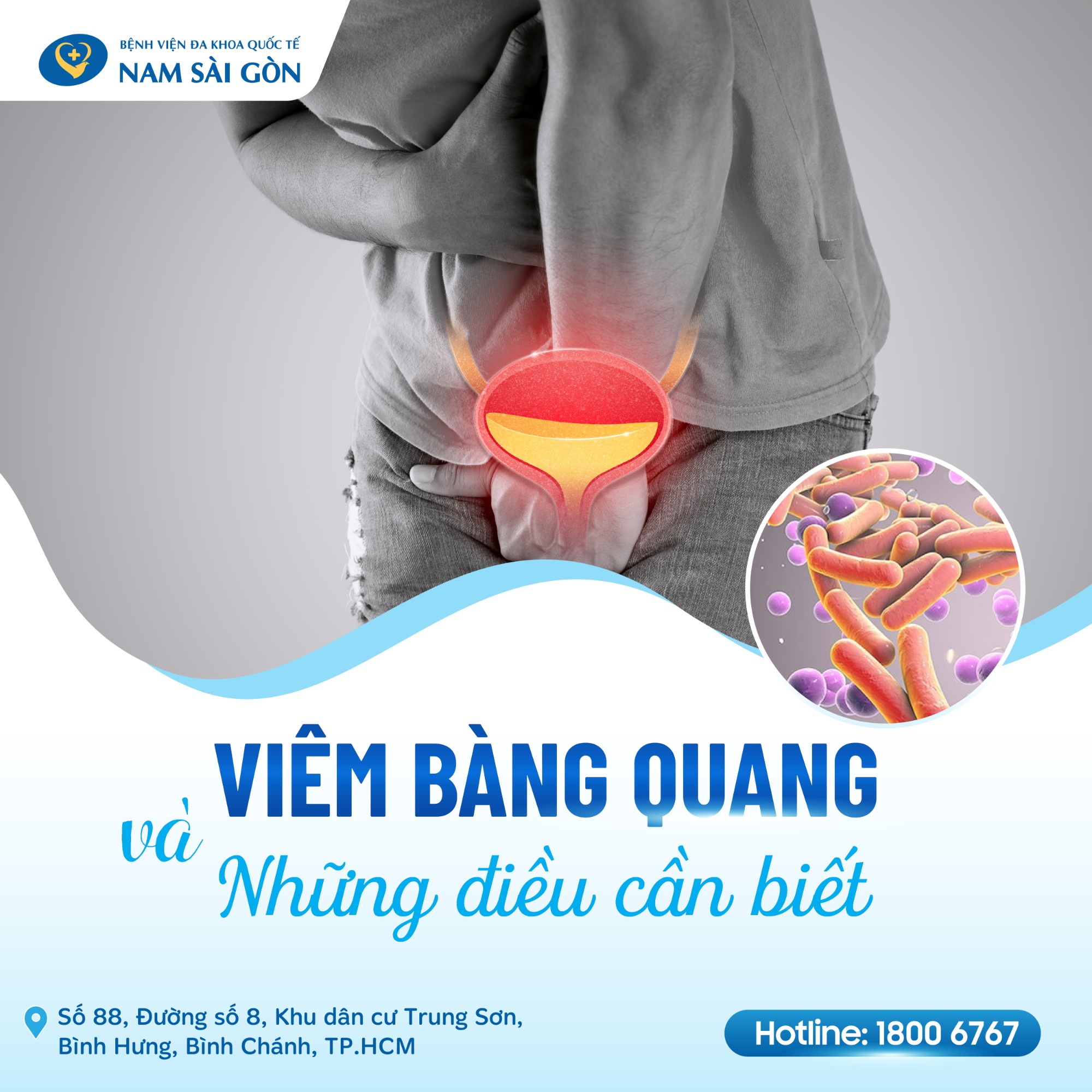 tiet nieu viem bang quang 01