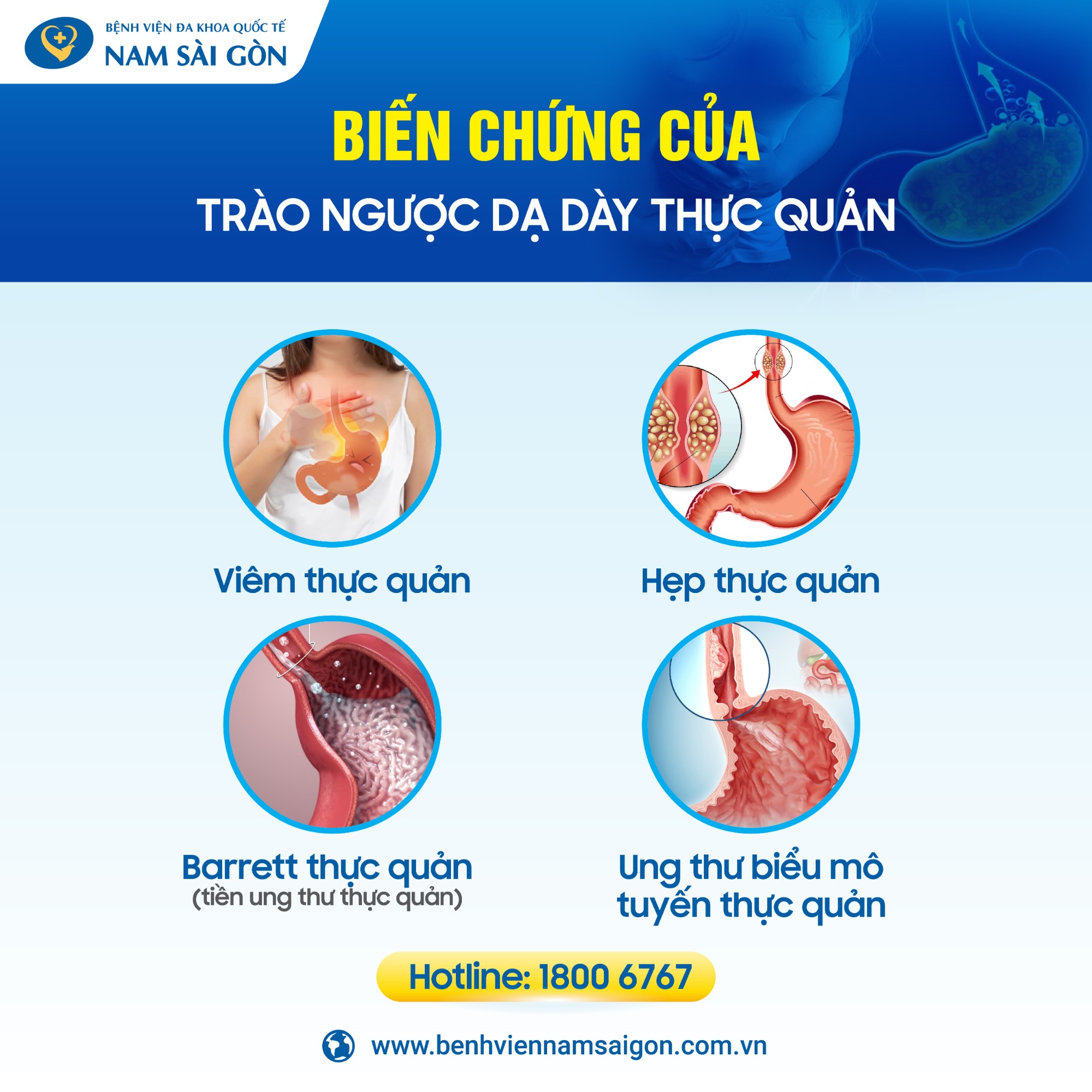 trao nguoc bac phuc 04 1