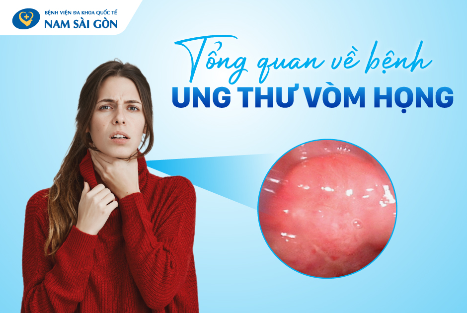 ung_thu_vom_hong_02_thumnail_web-3 ung thu vom hong 02 thumnail web 3