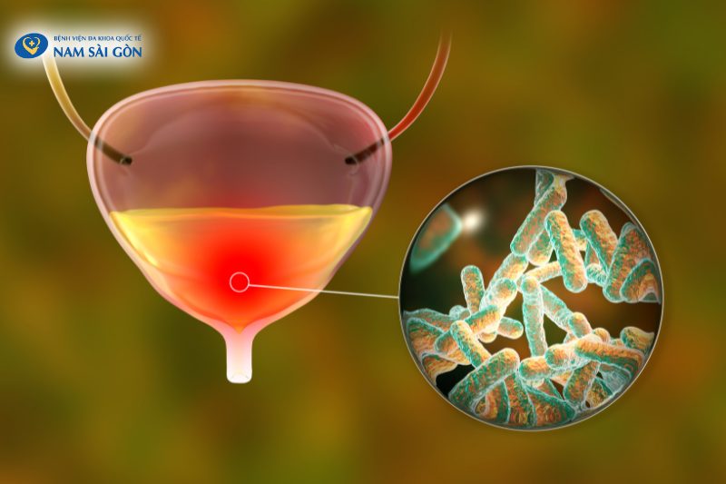 vi khuan escherichia coli chiem 80 nguyen nhan gay benh gay benh 1