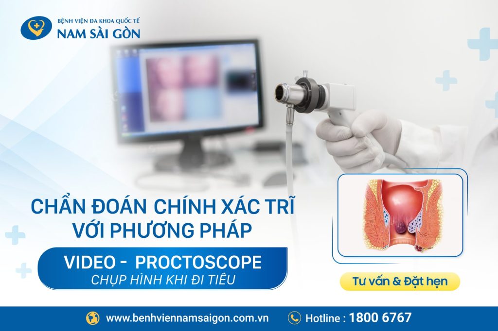 KỸ THUẬT MỚI GIÚP CHẨN ĐOÁN CHÍNH XÁC CẤP ĐỘ TRĨ VÀ SA TRỰC TRÀNG 2 video proctoscope 4