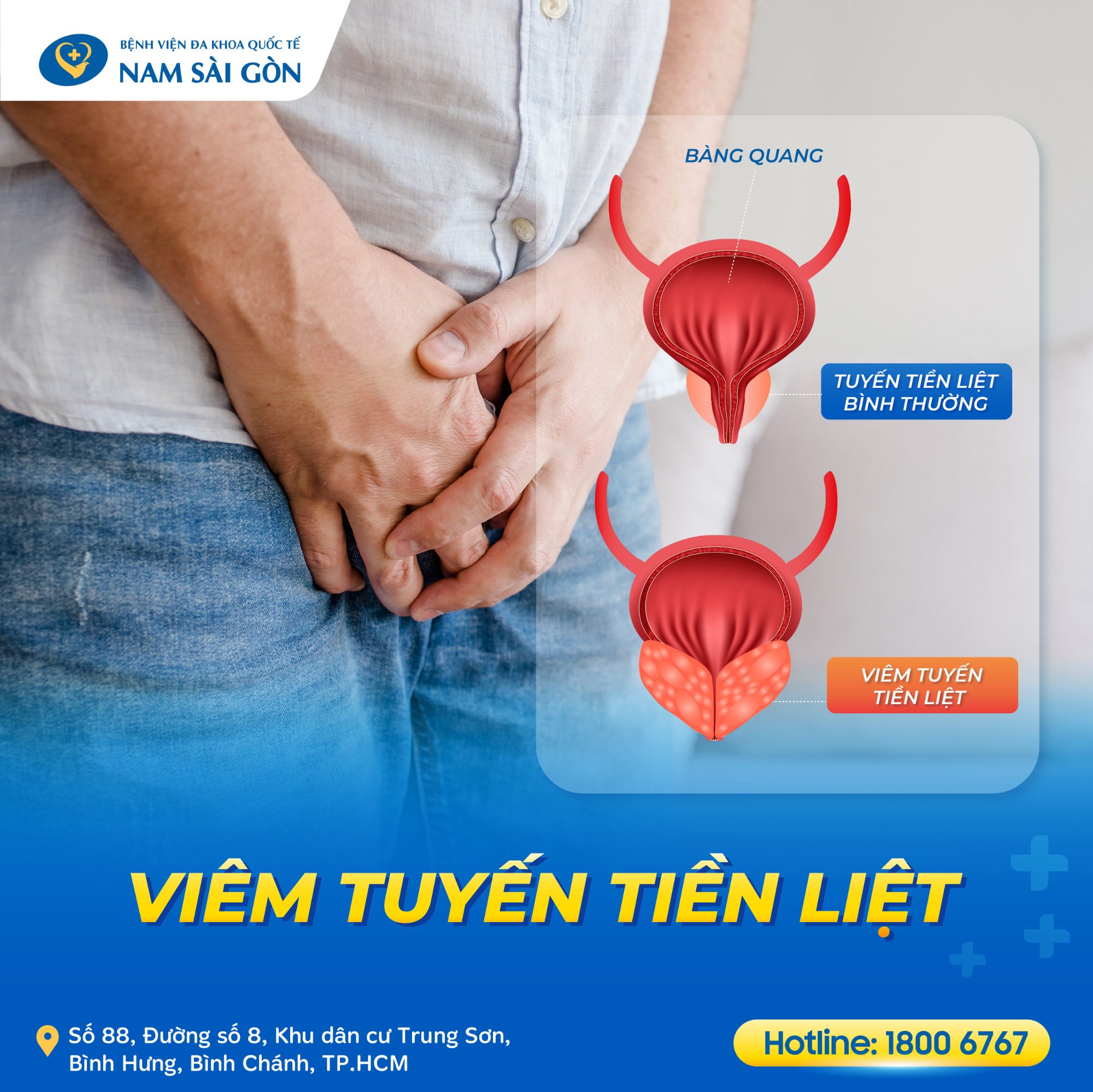 viem tuyen tien liet 02 1