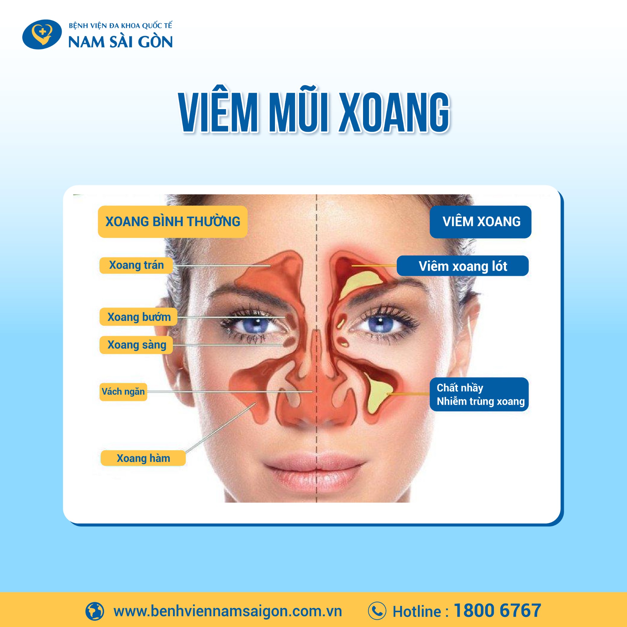 viemxoangmui 02 1