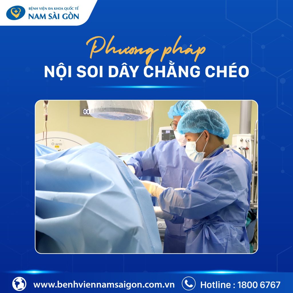 TỔN THƯƠNG DÂY CHẰNG CHÉO TRƯỚC CÓ CẦN PHẪU THUẬT KHÔNG? 5 web ton thuong day chang cheo 04 1