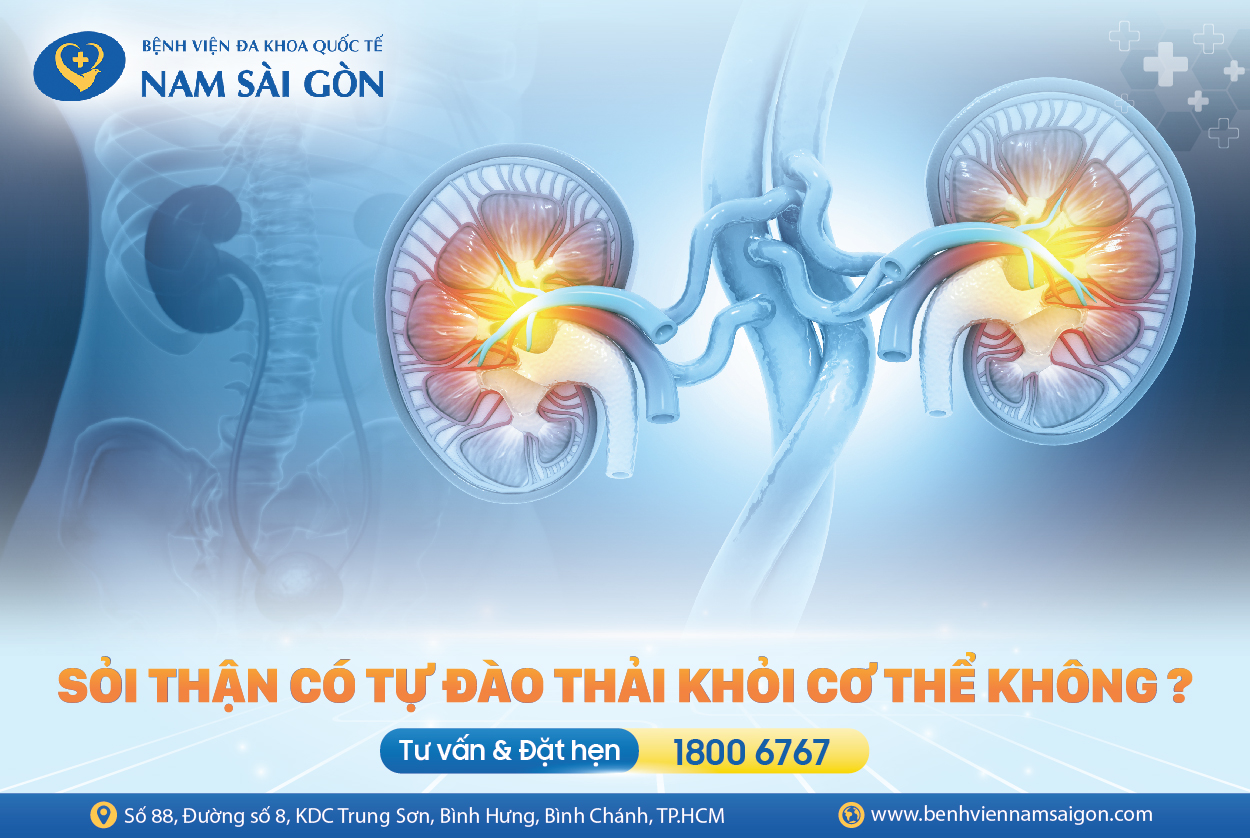 SỎI THẬN CÓ THỂ TỰ ĐÀO THẢI KHÔNG?