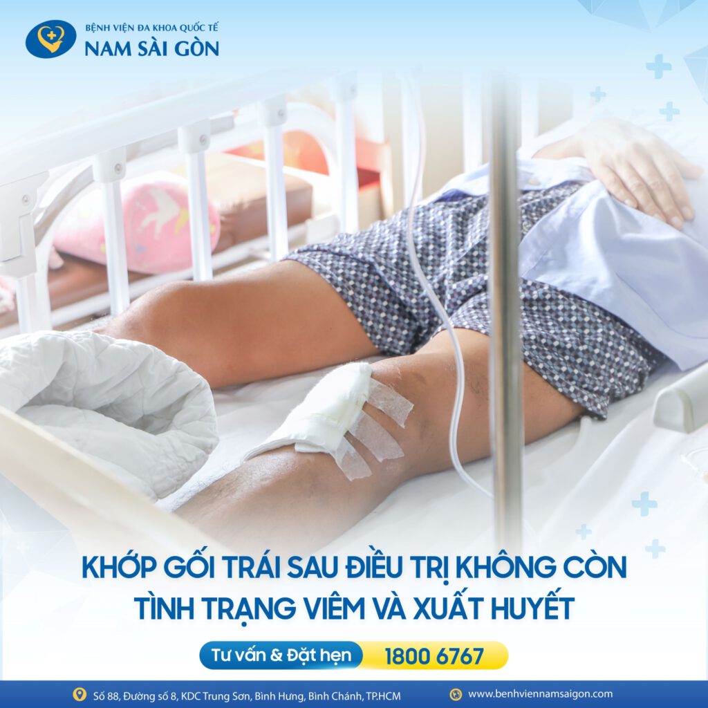 BẤT NGỜ PHÁT HIỆN NHIỄM “VI KHUẨN ĂN THỊT NGƯỜI” TỪ Ổ VIÊM KHỚP GỐI 5 THIET KE CA BENH HOUT VANNY 03