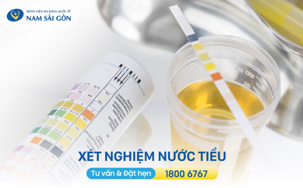 viêm bàng quang nữ