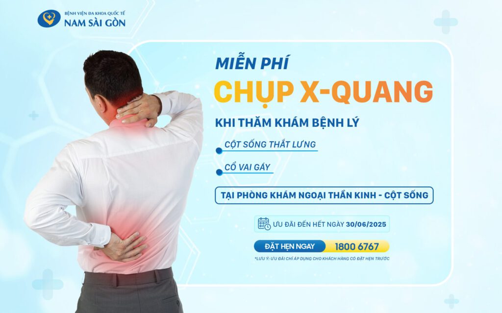 MIỄN PHÍ CHỤP X-QUANG TỪ 12/5/2025 ĐẾN 30/6/2025 2 Web