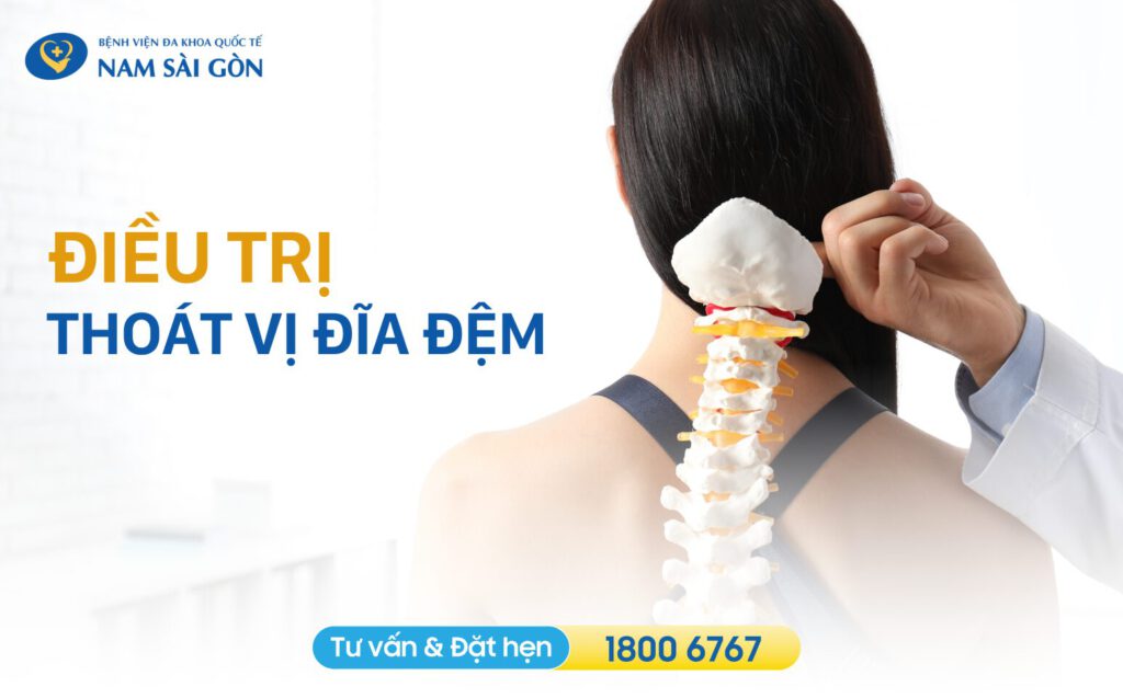 Điều thoát vị đĩa đệm như thế nào