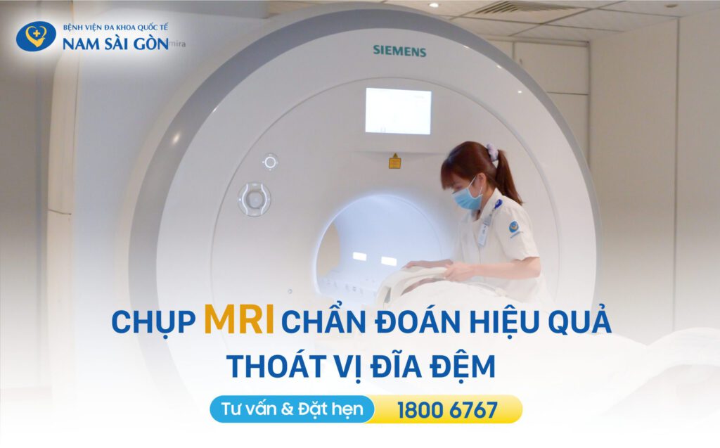 biểu hiện thoát vị đĩa đệm